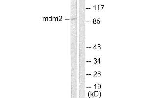Western Blotting (WB) image for anti-Mdm2, p53 E3 Ubiquitin Protein Ligase Homolog (Mouse) (MDM2) (C-Term) antibody (ABIN1848667) (MDM2 anticorps  (C-Term))