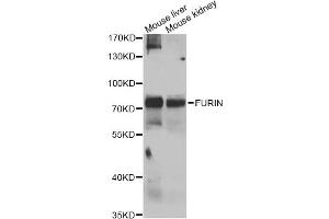 Western blot analysis of extracts of various cell lines, using FURIN antibody (ABIN4903706) at 1:1000 dilution. (FURIN anticorps)