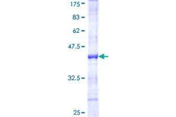 UHRF2 Protein (AA 81-180) (GST tag)