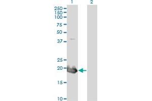 Western Blot analysis of HAND2 expression in transfected 293T cell line by HAND2 monoclonal antibody (M08), clone 4B11. (HAND2 anticorps  (AA 135-216))