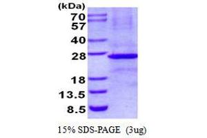 Image no. 1 for Ephrin B3 (EFNB3) protein (His tag) (ABIN1098662) (Ephrin B3 Protein (EFNB3) (His tag))