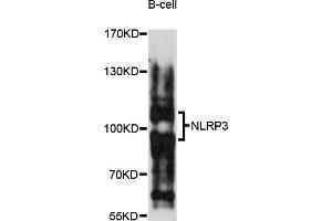 Western blot analysis of extracts of B-cell cells, using NLRP3 antibody (ABIN5973297) at 1/1000 dilution. (NLRP3 anticorps)
