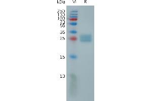 Human U Protein, His Tag on SDS-PAGE under reducing condition. (ULBP2 Protein (AA 26-216) (His tag))