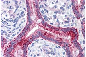 Human Small Intestine: Formalin-Fixed, Paraffin-Embedded (FFPE) (OAT anticorps)