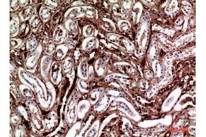 Immunohistochemical analysis of paraffin-embedded human-kidney, antibody was diluted at 1:100. (M-CSF/CSF1 anticorps  (C-Term))