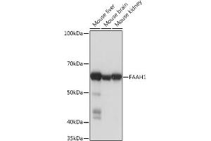 Western blot analysis of extracts of various cell lines, using F Rabbit mAb (ABIN1682600, ABIN3018533, ABIN3018534 and ABIN7101623) at 1:1000 dilution. (FAAH anticorps)