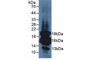 Figure. (Insulin anticorps  (AA 25-110))