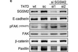 Western Blotting (WB) image for anti-Catenin (Cadherin-Associated Protein), beta 1, 88kDa (CTNNB1) (N-Term) antibody (ABIN2855042)