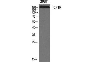 Western Blot (WB) analysis of specific cells using CFTR Polyclonal Antibody. (CFTR anticorps  (Ser246))
