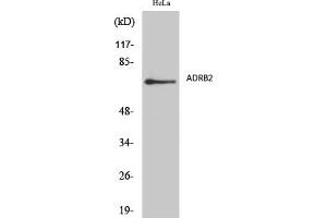 Western Blot analysis of various cells using AR-β2 Polyclonal Antibody diluted at 1:2000. (Androgen Receptor beta 2 anticorps  (AA 180-260))