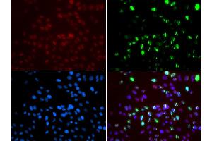 Immunofluorescence analysis of GFP-RNF168 trangenic U2OS cell using MSH6 antibody. (MSH6 anticorps)
