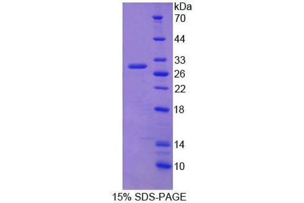 RRBP1 Protéine