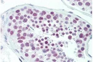 Human Testis: Formalin-Fixed, Paraffin-Embedded (FFPE) (LMO1 anticorps  (AA 96-145))