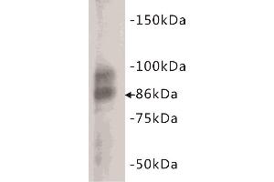 Western Blotting (WB) image for anti-Glycoprotein Hormones, alpha Polypeptide (CGA) (C-Term) antibody (ABIN1854868) (CGA anticorps  (C-Term))