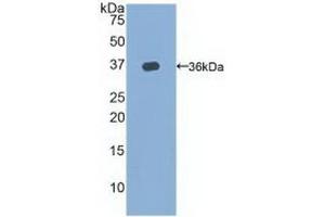 Detection of Recombinant TERT, Rat using Polyclonal Antibody to Telomerase Reverse Transcriptase (TERT) (TERT anticorps  (AA 673-976))