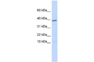 WB Suggested Anti-LEFTY1 Antibody Titration: 0. (LEFTY1 anticorps  (N-Term))