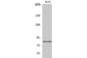 Western Blotting (WB) image for anti-Lipase, Hormone-Sensitive (LIPE) (Ser774) antibody (ABIN3175557) (LIPE anticorps  (Ser774))