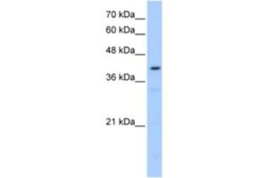 Western Blotting (WB) image for anti-Protein-O-Mannosyltransferase 2 (POMT2) antibody (ABIN2463031) (POMT2 anticorps)