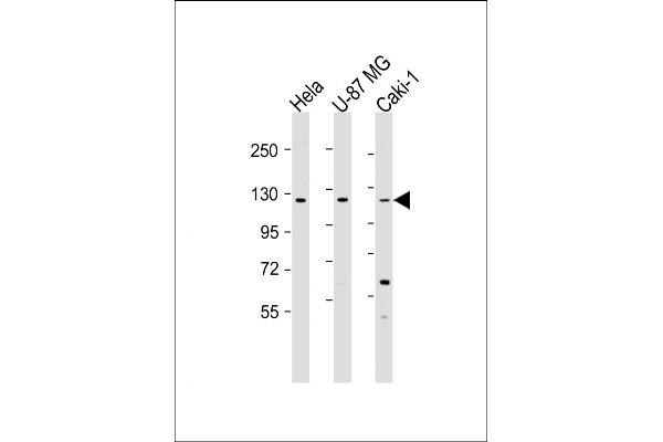 STARD8 anticorps  (AA 220-255)