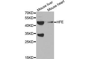 Western blot analysis of extracts of mouse brain and mouse heart tissues, using HFE antibody. (HFE anticorps)