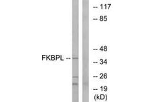 Western blot analysis of extracts from Jurkat cells, using FKBPL Antibody. (FKBPL anticorps  (AA 251-300))