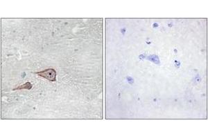 Immunohistochemistry analysis of paraffin-embedded human brain tissue, using CDH3 Antibody. (P-Cadherin anticorps  (AA 51-100))