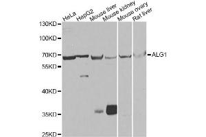 Western blot analysis of extracts of various cell lines, using ALG1 antibody (ABIN5975731) at 1/1000 dilution. (ALG1 anticorps)