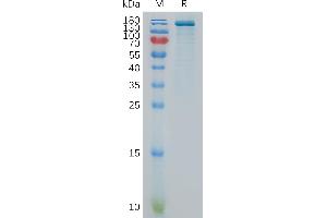 Human E Protein, hFc Tag on SDS-PAGE under reducing condition. (ENPP3 Protein (Fc Tag))