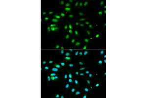 Immunofluorescence analysis of MCF7 cell using PAX3 antibody. (Paired Box 3 anticorps)