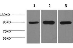 Western Blotting (WB) image for anti-Heat Shock Protein 90kDa alpha (Cytosolic), Class A Member 2 (HSP90AA2) antibody (ABIN5961311) (HSP90AA2 anticorps)