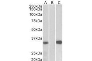 Image no. 1 for anti-Kv Channel Interacting Protein 3, Calsenilin (KCNIP3) (AA 21-31) antibody (ABIN1102701) (DREAM anticorps  (AA 21-31))