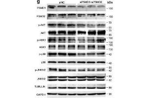 PSMD1 and PSMD2 regulate the expression level of fatty acids (FAs) and lipid synthesis-related genes. (MAPK14 anticorps  (C-Term))