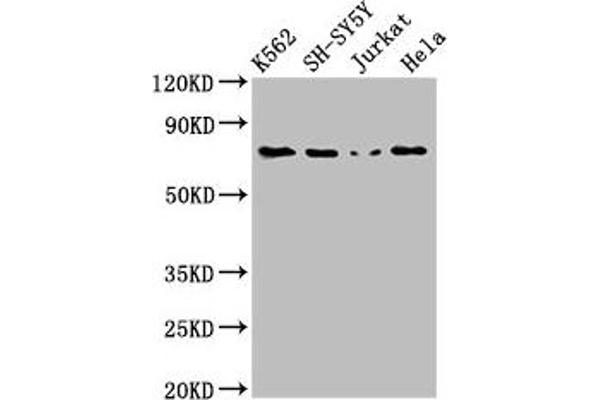 PKC beta anticorps  (AA 517-643)