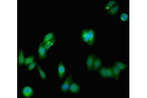 Immunofluorescent analysis of HepG2 cells using ABIN7161294 at dilution of 1:100 and Alexa Fluor 488-congugated AffiniPure Goat Anti-Rabbit IgG(H+L) (Notch1 anticorps  (AA 2428-2555))