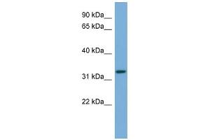 WB Suggested Anti-ATG3 Antibody Titration: 0. (ATG3 anticorps  (Middle Region))