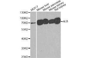 Western blot analysis of extracts of various cell lines, using ALB antibody (ABIN5970637) at 1/500 dilution. (Albumin anticorps)