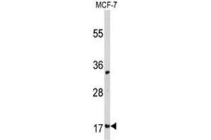 Western blot analysis of Destrin  Antibody  in MCF-7 cell line lysates (35ug/lane). (Destrin anticorps  (Middle Region))