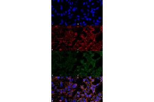 Immunocytochemistry/Immunofluorescence analysis using Mouse Anti-4-Hydroxynonenal Monoclonal Antibody, Clone 12F7 . (HNE anticorps  (PE))