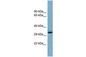 Image no. 1 for anti-OTU Domain Containing 6B (OTUD6B) (C-Term) antibody (ABIN6741941) (OTUD6B anticorps  (C-Term))