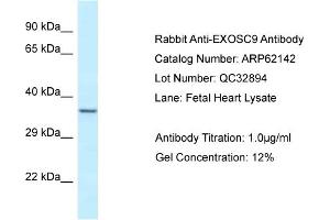Western Blotting (WB) image for anti-Exosome Component 9 (EXOSC9) (N-Term) antibody (ABIN970651) (EXOSC9 anticorps  (N-Term))