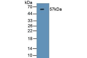 Detection of Recombinant FOXP3, Mouse using Monoclonal Antibody to Forkhead Box P3 (FOXP3) (FOXP3 anticorps  (AA 190-412))
