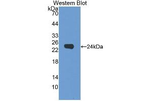 Western blot analysis of the recombinant protein. (Dermokine anticorps  (AA 27-238))