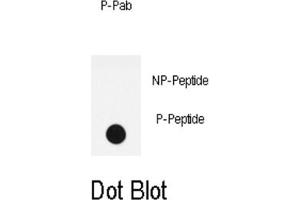 Dot Blot (DB) image for anti-LPR1 (pSer4520) antibody (ABIN3001761) (LPR1 (pSer4520) anticorps)