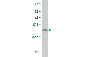 Western Blot detection against Immunogen (37. (CER1 anticorps  (AA 158-266))