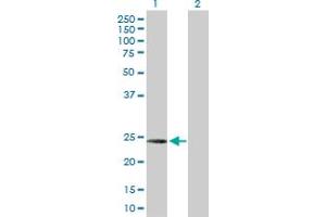 Western Blot analysis of C1QC expression in transfected 293T cell line by C1QC MaxPab polyclonal antibody. (C1QC anticorps  (AA 1-245))