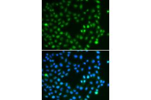 Immunofluorescence analysis of A549 cells using SALL4 antibody (ABIN5974283). (SALL4 anticorps)