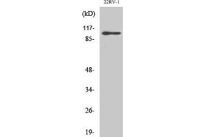 Western Blot analysis of various cells using GluR-2 Polyclonal Antibody. (GRIA2 anticorps)