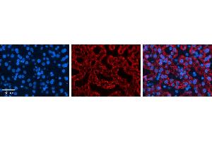 CTAGE5 antibody - middle region          Formalin Fixed Paraffin Embedded Tissue:  Human Liver Tissue    Observed Staining:  Cytoplasm in hepatocytes   Primary Antibody Concentration:  1:600    Secondary Antibody:  Donkey anti-Rabbit-Cy3    Secondary Antibody Concentration:  1:200    Magnification:  20X    Exposure Time:  0. (MIA2 anticorps  (Middle Region))