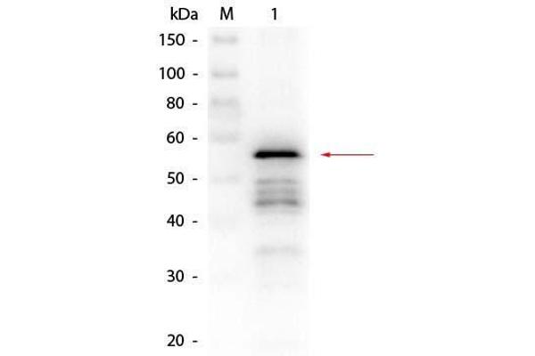 Aldehyde Dehydrogenase anticorps