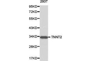 Western Blotting (WB) image for anti-Cardiac Troponin T (cTnT) antibody (ABIN1875151) (Cardiac Troponin T2 anticorps)